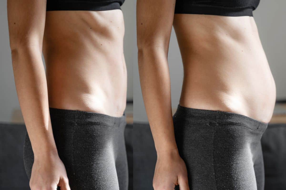 How long does diastasis recti take to improve Bedford Park?