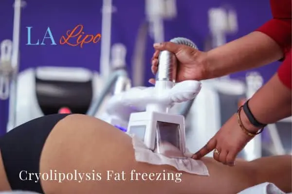 women getting fat freezing Bedford Park