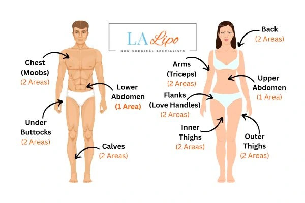 LA LIPO Cryolipolysis Areas Bedford Park