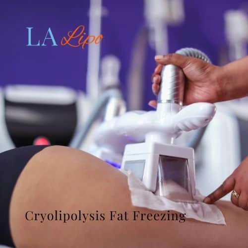 fat freezing - Cryolipolysis Bedford Park