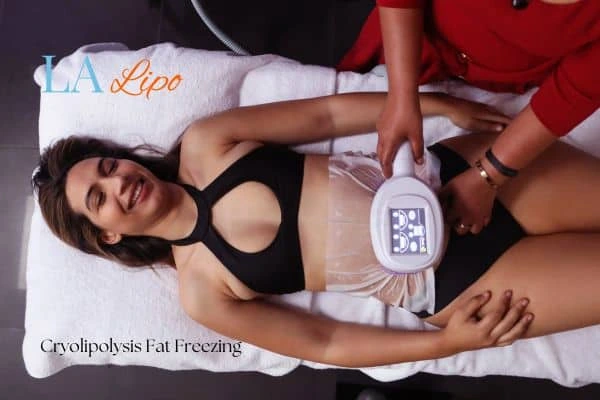 woman getting cryolipolysis Bedford Park