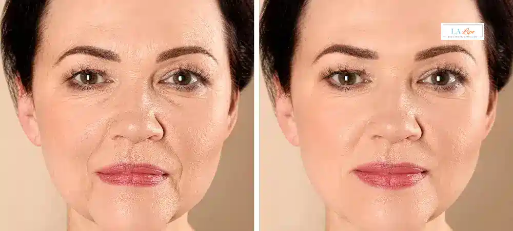 How Long Does It Take to See Results and How Long Do They Last Bedford Park?