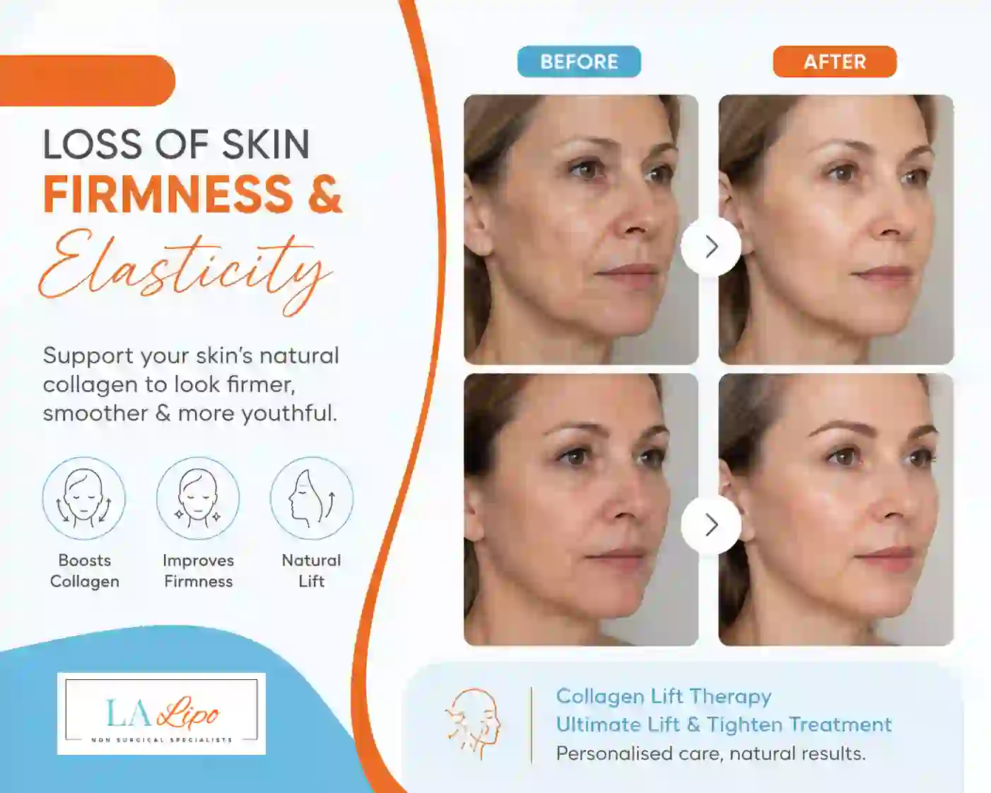 Sign #7: Loss of Skin Firmness and Elasticity Bedford Park